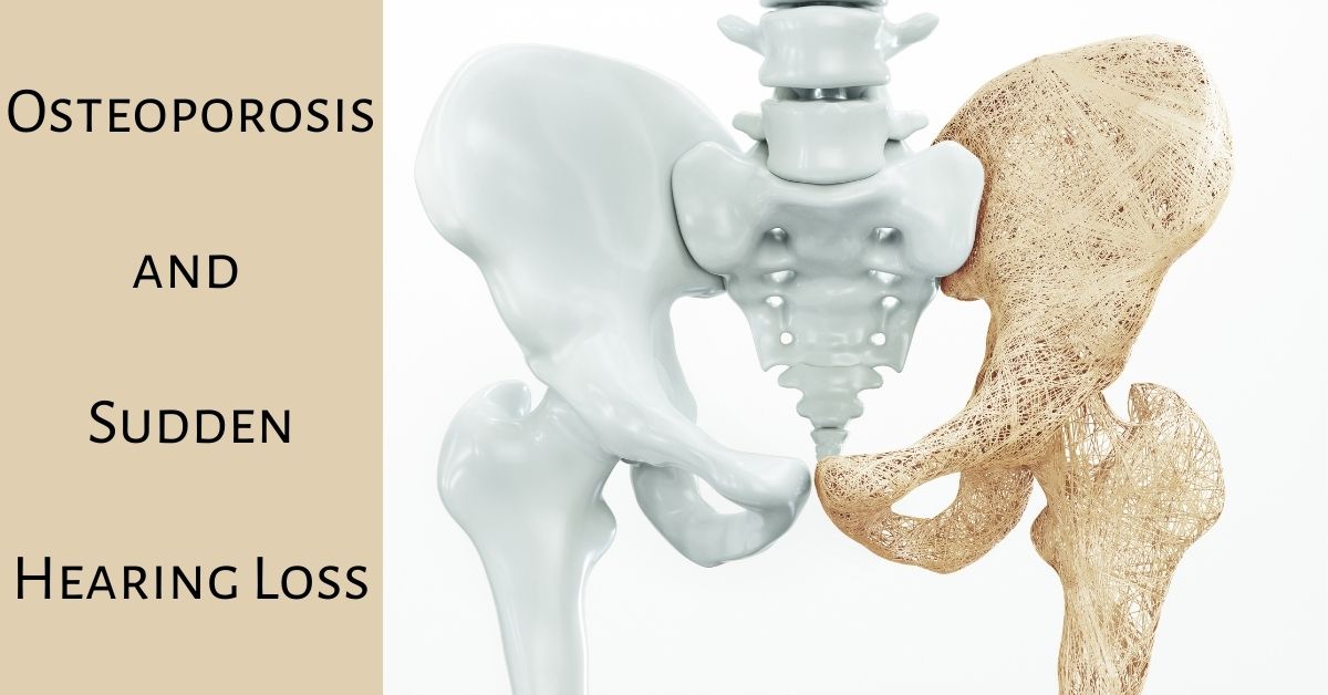 Osteoporosis and Hearing Loss